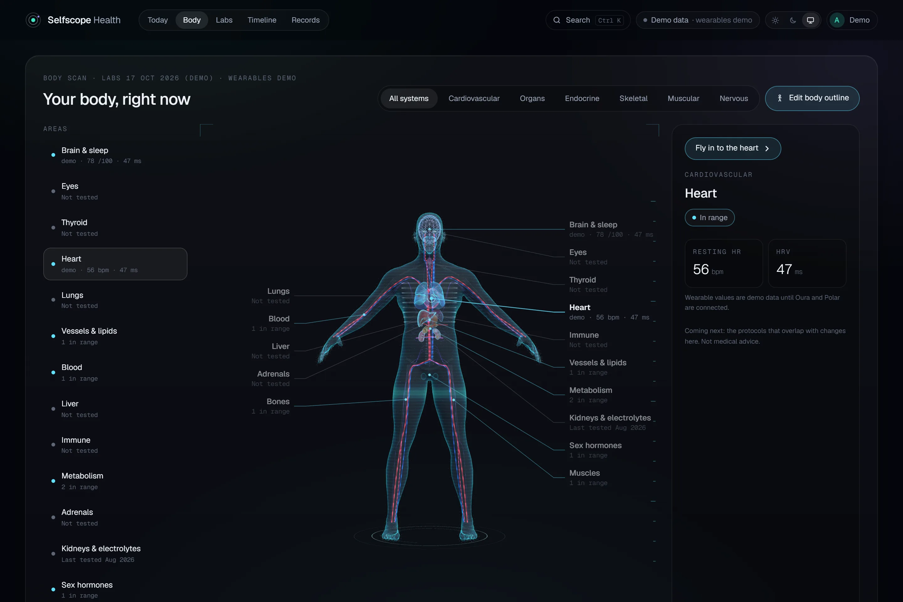The Selfscope body view: a 3D body with organs, each area labelled with its lab results (sample data).