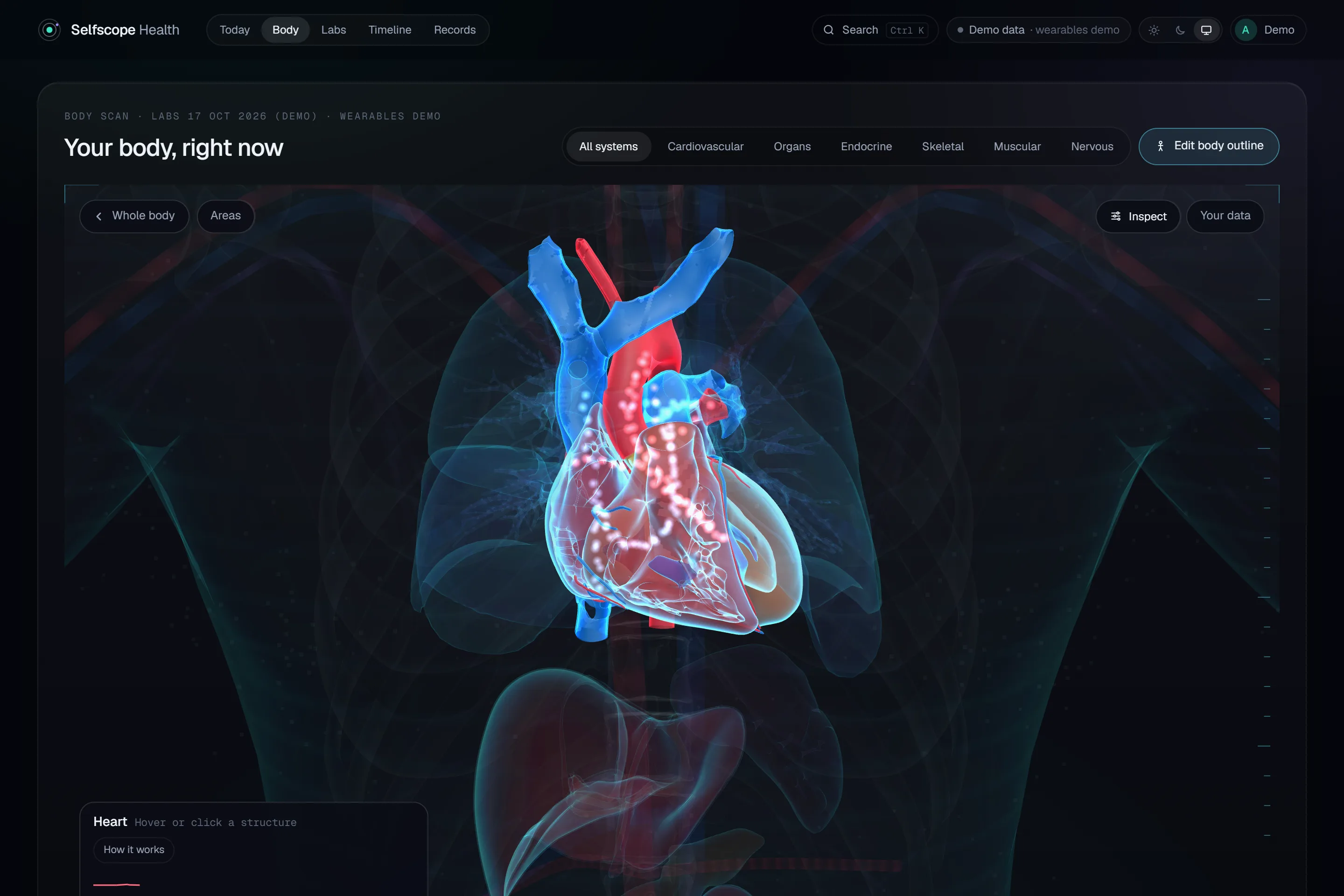 The 3D heart up close, with arteries and veins (sample data).